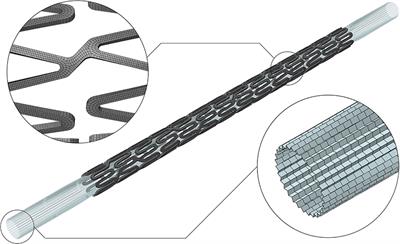 How to Validate in silico Deployment of Coronary Stents: Strategies and Limitations in the Choice of Comparator